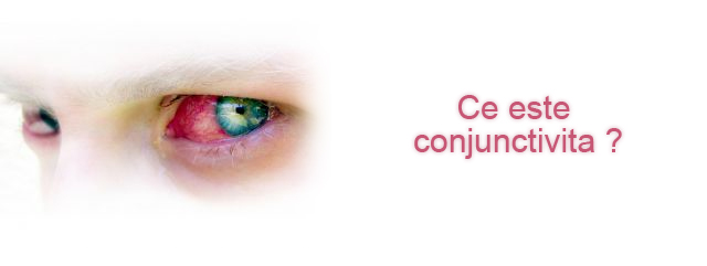 Conjunctivita este o inflamatie a membranei care acopera partea alba ochilor si partea interna a pleopelor. Aceasta membrana se cheama conjunctiva. Cand conjunctiva (membrana) este iritata, vasele de sange se...