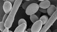 Detectie boli cu transmitere sexuala ce produc infertilitatea Detectie BTS (ce produc infertilitate) si infectii urinare prin PCR (Polymerase Chain Reaction): Boli cu transmitere sexuala (BTS) : A. Chlamidia Trachomatis este o bacterie care determina infectii ale tractului...
