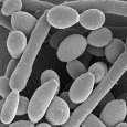 Detectie BTS (ce produc infertilitate) si infectii urinare prin PCR (Polymerase Chain Reaction).